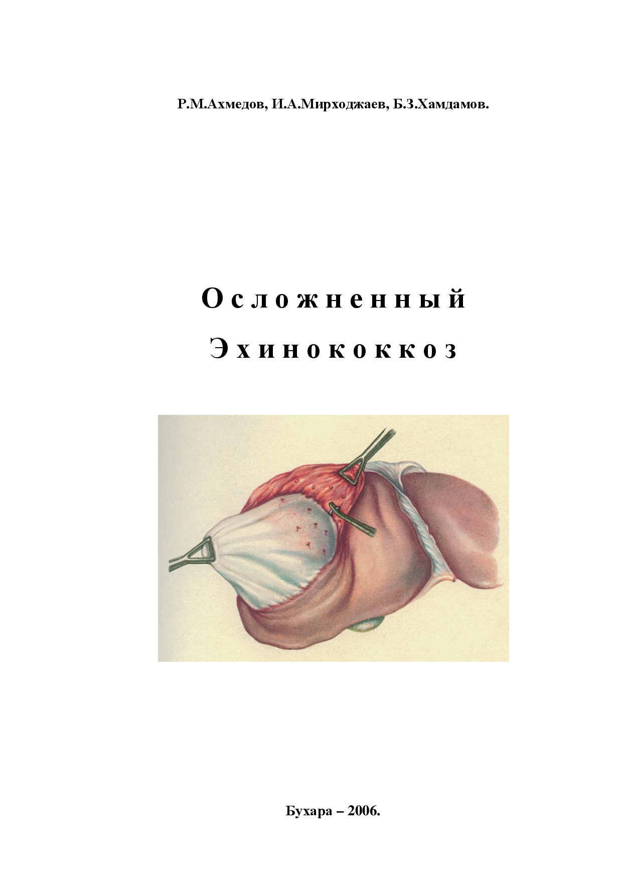 эхинококкоз. монография