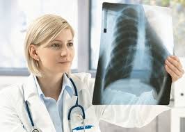 Öýkenleriň idiopatiki fibrozy