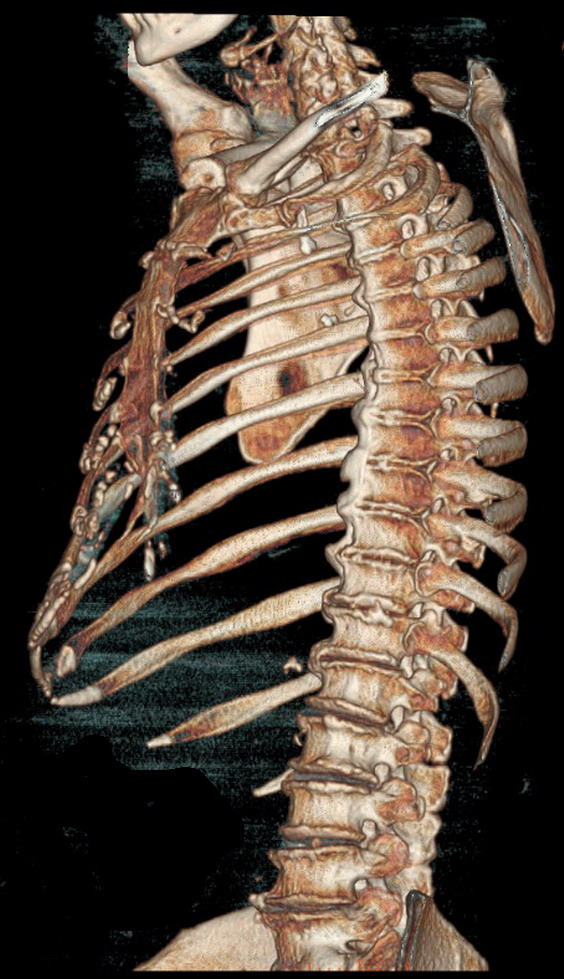 Rentgen barlagy. rentgenoskopiýa, rentgenografiýa,...