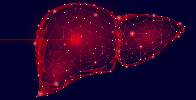 Bagyr sirrozy. assit