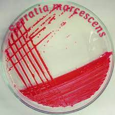 Serratia, Hafnia, Enterobacter va Edwardsiella